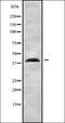 C-C Motif Chemokine Receptor 3 antibody, orb336390, Biorbyt, Western Blot image 