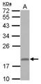 Ring Finger Protein 181 antibody, NBP2-20181, Novus Biologicals, Western Blot image 
