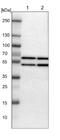 Tyrosyl-TRNA Synthetase antibody, NBP1-86890, Novus Biologicals, Western Blot image 