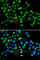 Polypeptide N-Acetylgalactosaminyltransferase 2 antibody, A6910, ABclonal Technology, Immunofluorescence image 