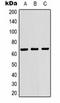 p65 antibody, orb323181, Biorbyt, Western Blot image 