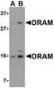 DNA damage-regulated autophagy modulator protein 1 antibody, LS-B2725, Lifespan Biosciences, Western Blot image 