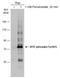ATK antibody, GTX133592, GeneTex, Western Blot image 