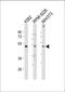 Myocyte-specific enhancer factor 2C antibody, A01131, Boster Biological Technology, Western Blot image 