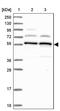 Chromosome 5 Open Reading Frame 22 antibody, PA5-60225, Invitrogen Antibodies, Western Blot image 