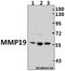 Matrix Metallopeptidase 19 antibody, A05171-2, Boster Biological Technology, Western Blot image 