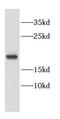 Cannabinoid Receptor Interacting Protein 1 antibody, FNab01818, FineTest, Western Blot image 