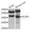 Killer Cell Lectin Like Receptor B1 antibody, abx006405, Abbexa, Western Blot image 