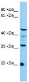 Cms1 Ribosomal Small Subunit Homolog antibody, TA331693, Origene, Western Blot image 
