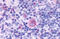 C-C Motif Chemokine Receptor Like 2 antibody, MBS247361, MyBioSource, Immunohistochemistry frozen image 