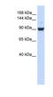 DExH-Box Helicase 34 antibody, NBP1-57294, Novus Biologicals, Western Blot image 