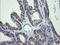 Cancer/Testis Antigen 1B antibody, LS-C174394, Lifespan Biosciences, Immunohistochemistry paraffin image 
