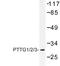 PTTG1 Regulator Of Sister Chromatid Separation, Securin antibody, LS-C176719, Lifespan Biosciences, Western Blot image 