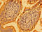 PH and SEC7 domain-containing protein 1 antibody, CSB-PA018842LA01HU, Cusabio, Immunohistochemistry paraffin image 