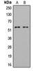 LYN Proto-Oncogene, Src Family Tyrosine Kinase antibody, orb216146, Biorbyt, Western Blot image 