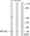Protein Phosphatase 1 Regulatory Inhibitor Subunit 14C antibody, LS-C119158, Lifespan Biosciences, Western Blot image 
