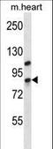 DEAH-Box Helicase 32 (Putative) antibody, LS-C167408, Lifespan Biosciences, Western Blot image 