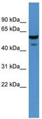 Carbohydrate Sulfotransferase 11 antibody, TA342376, Origene, Western Blot image 