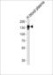 Ceruloplasmin antibody, 62-836, ProSci, Western Blot image 