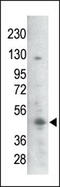 Glycogen Synthase Kinase 3 Beta antibody, TA324769, Origene, Western Blot image 