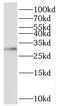 Translocase Of Inner Mitochondrial Membrane 29 antibody, FNab01052, FineTest, Western Blot image 