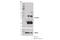 Cancer/Testis Antigen 1B antibody, 45437S, Cell Signaling Technology, Western Blot image 