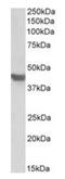 Solute Carrier Family 2 Member 4 antibody, orb20638, Biorbyt, Western Blot image 