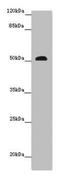 Retinoid-inducible serine carboxypeptidase antibody, LS-C679405, Lifespan Biosciences, Western Blot image 