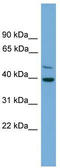 Chromosome 21 Open Reading Frame 58 antibody, TA338951, Origene, Western Blot image 