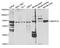 Bone Morphogenetic Protein Receptor Type 1A antibody, A1816, ABclonal Technology, Western Blot image 