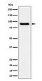 Complement C1s antibody, M02057-3, Boster Biological Technology, Western Blot image 