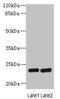 Retinal Degeneration 3, GUCY2D Regulator antibody, orb34043, Biorbyt, Western Blot image 