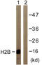 Histone H2B antibody, LS-B7716, Lifespan Biosciences, Western Blot image 