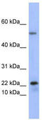 Phospholipase A2 Group V antibody, TA346054, Origene, Western Blot image 