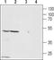 Zinc Activated Ion Channel antibody, TA328661, Origene, Western Blot image 