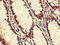 Pantothenate Kinase 2 antibody, CSB-PA874850LA01HU, Cusabio, Immunohistochemistry frozen image 