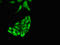 Lysine-specific demethylase 4D antibody, orb53487, Biorbyt, Immunofluorescence image 