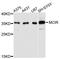 Melanocortin 1 Receptor antibody, A11803, ABclonal Technology, Western Blot image 