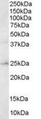 Hydroxysteroid 17-Beta Dehydrogenase 10 antibody, MBS421448, MyBioSource, Western Blot image 