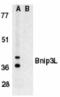 BCL2/adenovirus E1B 19 kDa protein-interacting protein 3-like antibody, TA306045, Origene, Western Blot image 