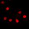 F-Box And Leucine Rich Repeat Protein 5 antibody, orb373288, Biorbyt, Immunofluorescence image 