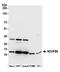 NADH dehydrogenase [ubiquinone] 1 beta subcomplex subunit 6 antibody, A305-436A, Bethyl Labs, Western Blot image 