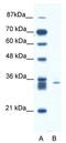 Siah E3 Ubiquitin Protein Ligase 1 antibody, TA334774, Origene, Western Blot image 