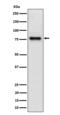 Thyroid Hormone Receptor Interactor 10 antibody, M03963, Boster Biological Technology, Western Blot image 