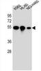 Putative tubulin beta chain-like protein ENSP00000290377 antibody, AP54595PU-N, Origene, Western Blot image 