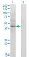 Sterol O-Acyltransferase 2 antibody, LS-C196598, Lifespan Biosciences, Western Blot image 