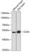 Ceroid-lipofuscinosis neuronal protein 5 antibody, GTX66133, GeneTex, Western Blot image 