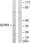 Tumor Protein P53 Inducible Protein 3 antibody, A30504, Boster Biological Technology, Western Blot image 