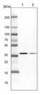 Cyclin Dependent Kinase 20 antibody, NBP1-91214, Novus Biologicals, Western Blot image 