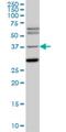 ISL LIM Homeobox 1 antibody, H00003670-M05, Novus Biologicals, Western Blot image 